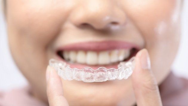 What Are the Benefits of Invisalign?